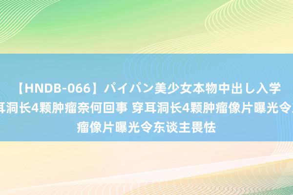 【HNDB-066】パイパン美少女本物中出し入学式！！ 穿耳洞长4颗肿瘤奈何回事 穿耳洞长4颗肿瘤像片曝光令东谈主畏怯